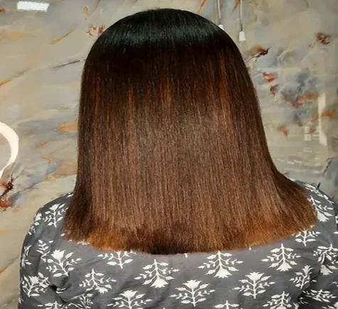 Nanoplastia Treatment in Coimbatore